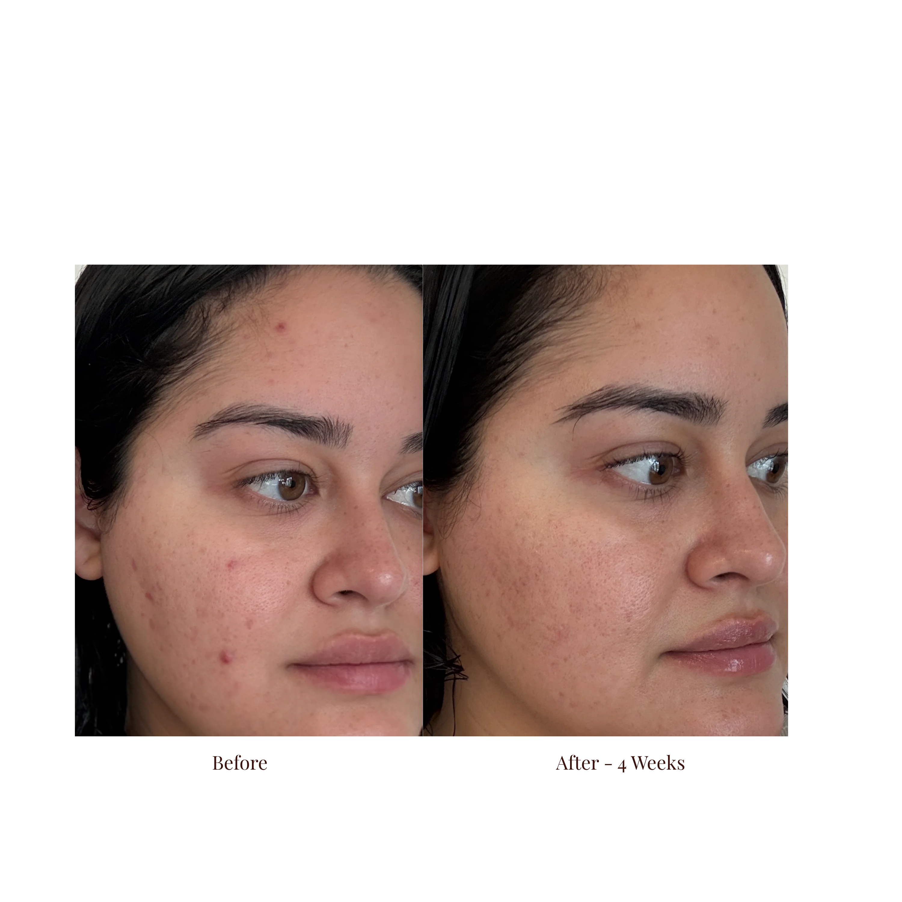 The Elixir Toner Essence