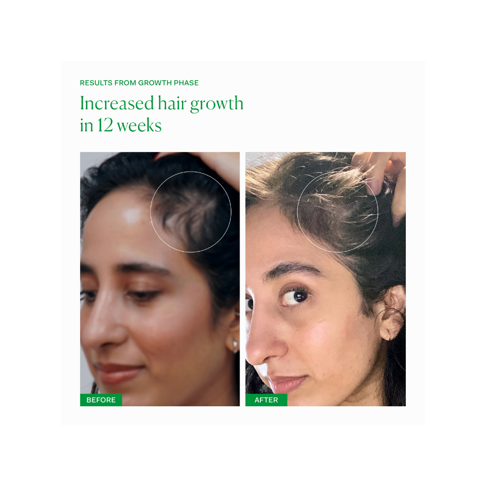 Growth Phase Hair Supplement