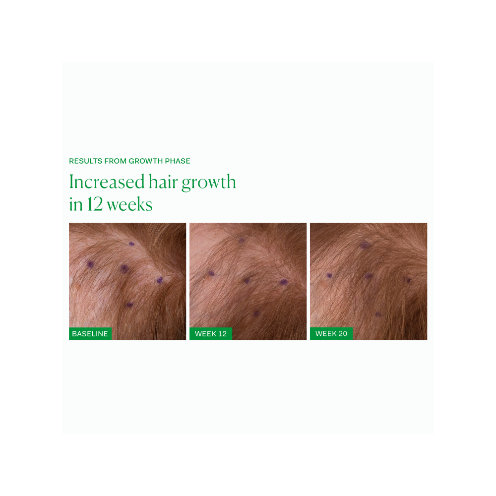 Growth Phase Hair Supplement