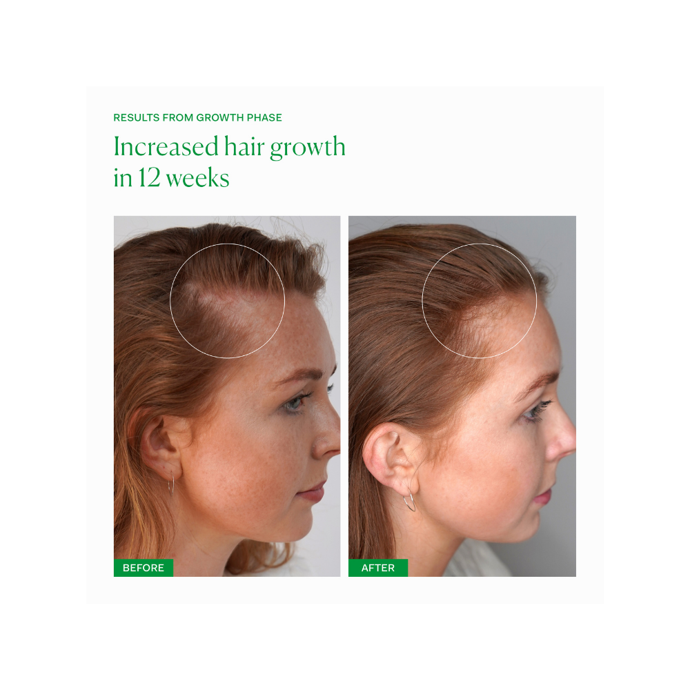 Growth Phase Hair Supplement