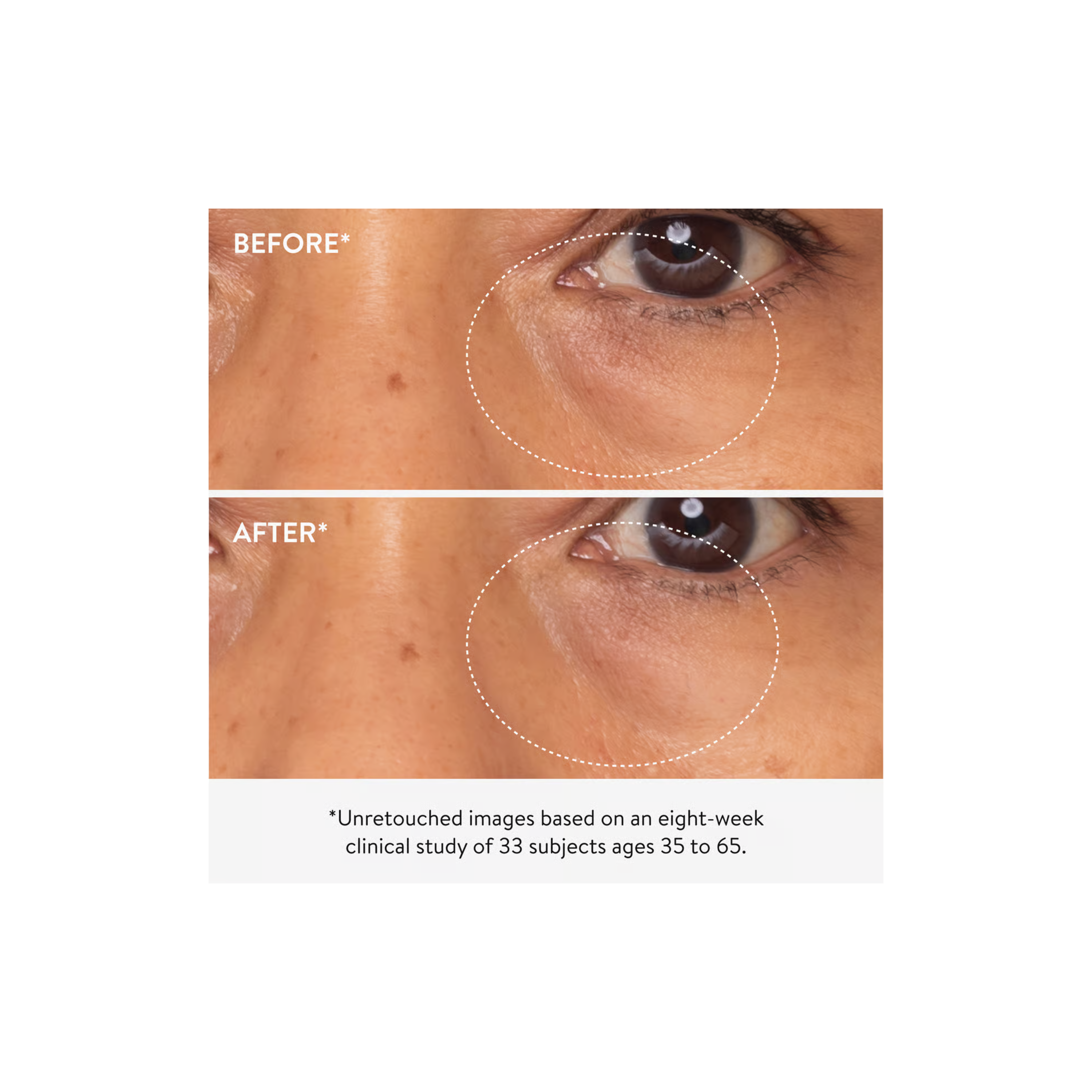 3x Retinol Eye Lift Serum