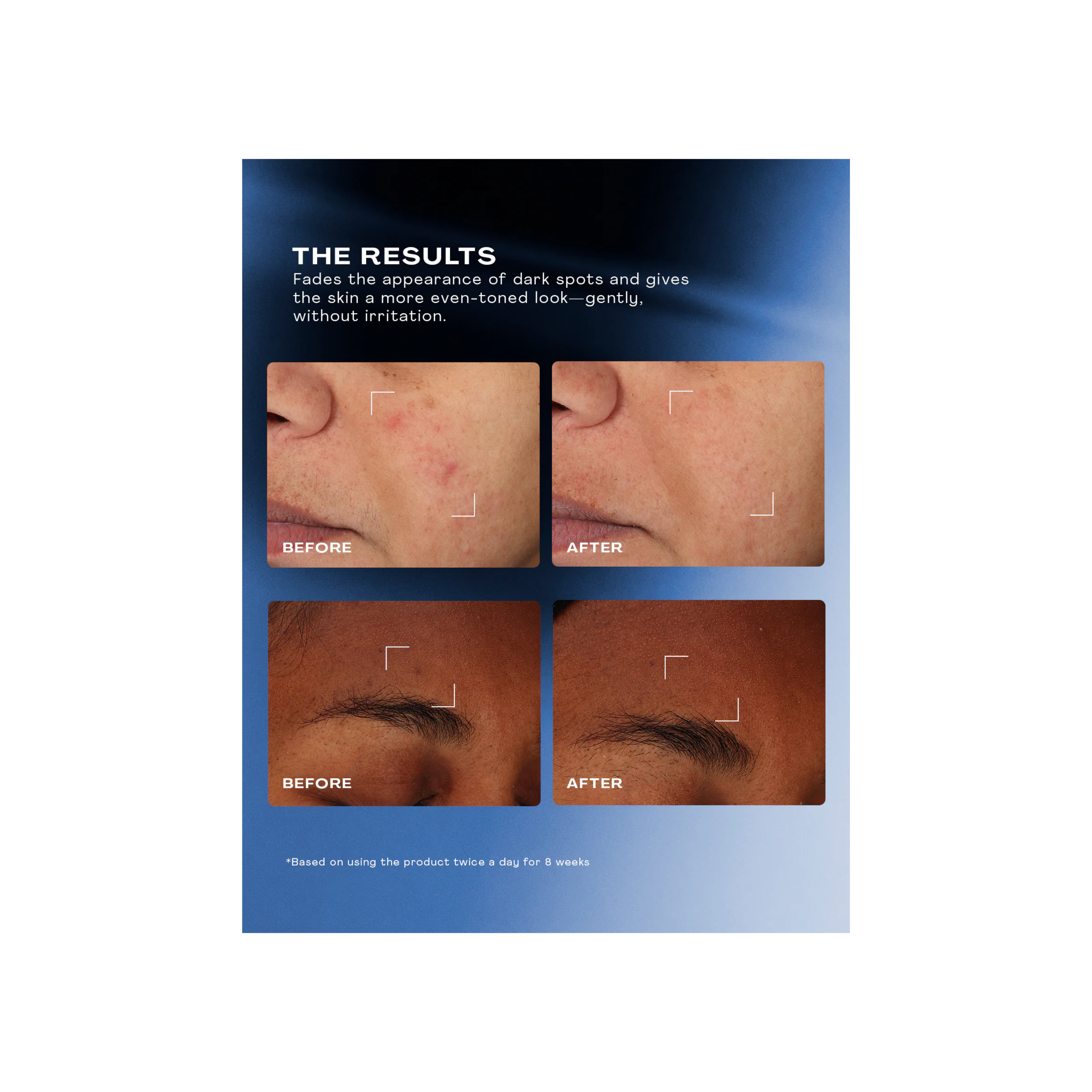 Total Clarity Dark Spot Serum