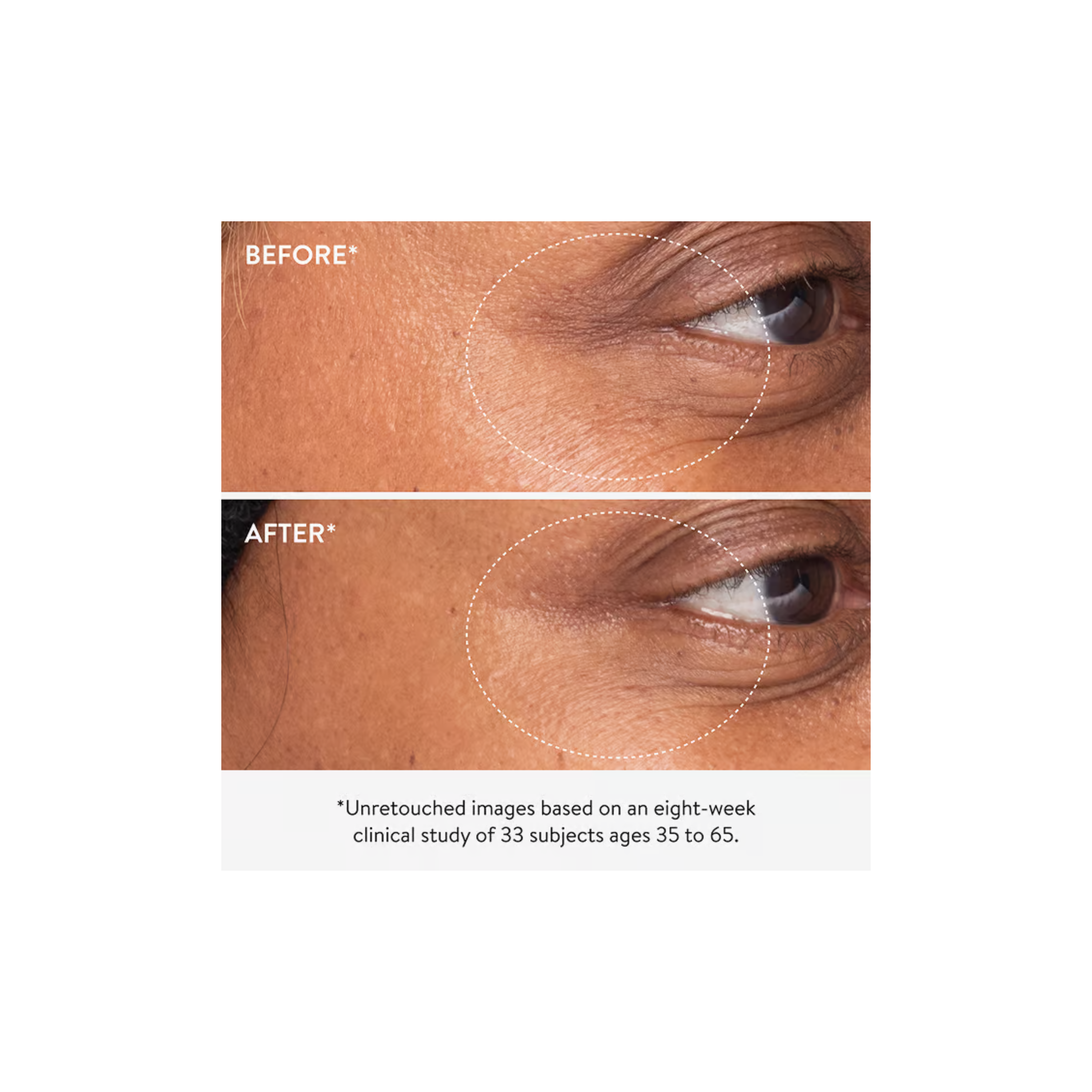 3x Retinol Eye Lift Serum